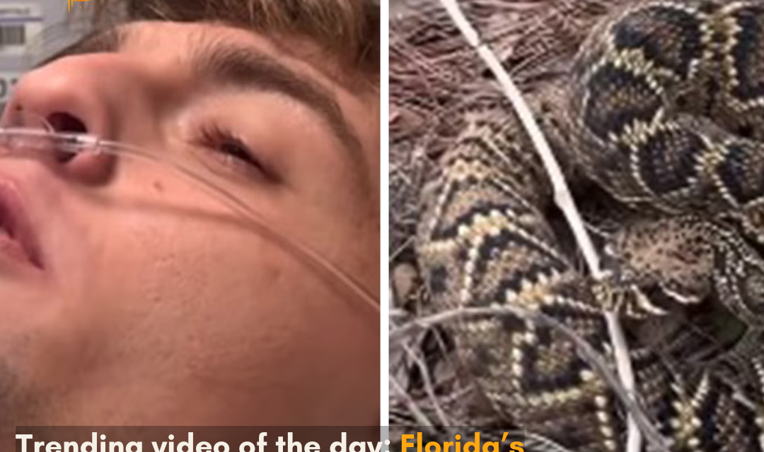 The influencer got bitten by a deadly rattlesnake, but he chose to film the rattlesnake that bit him, making the video go viral on the internet.